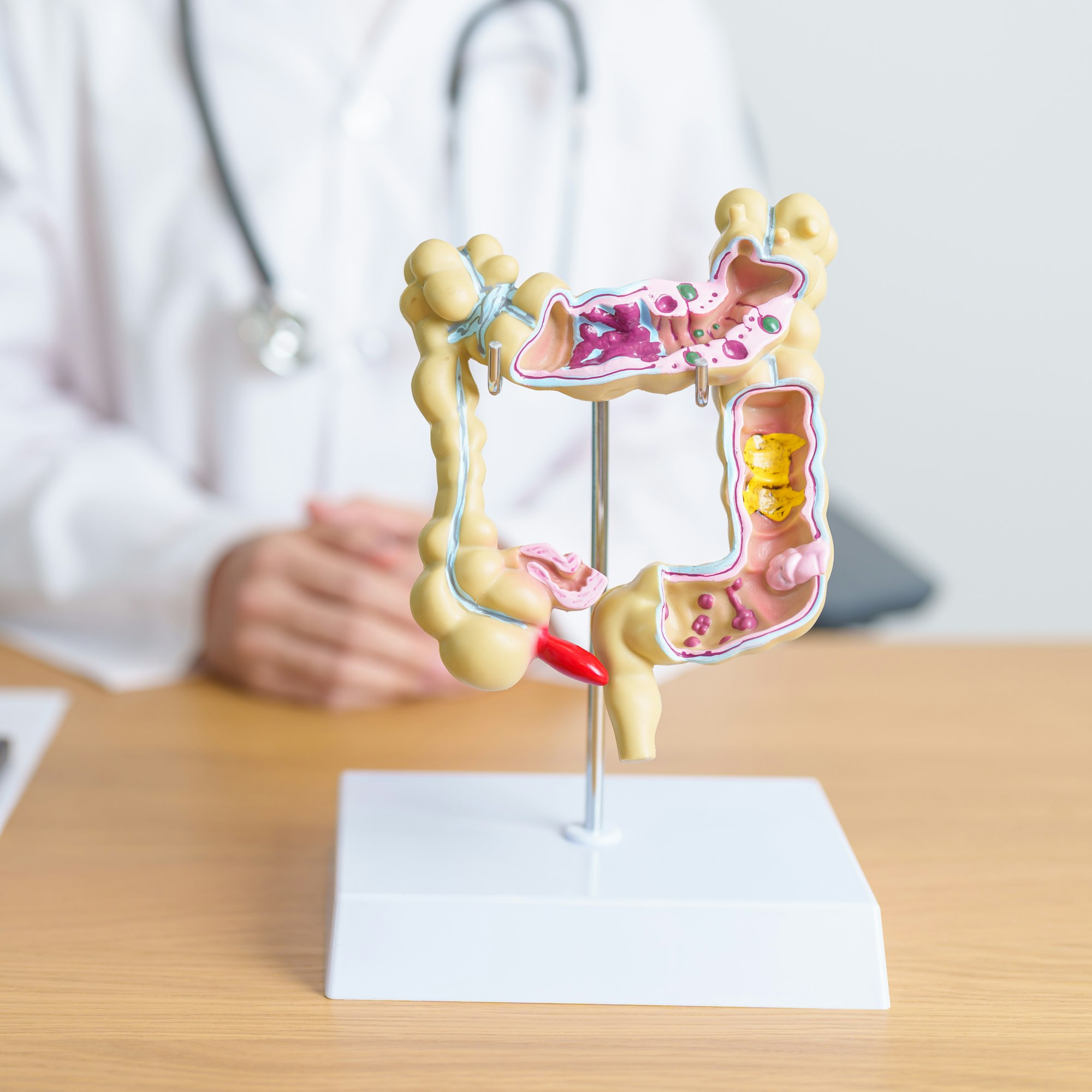 Doctor with human Colon anatomy model.